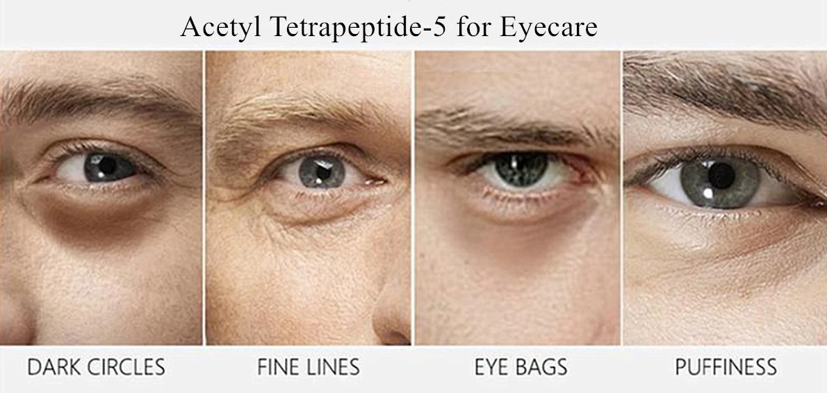 Acetyl Tetrapeptide-5 for eyecare Acetyl Tetrapeptide-5 for eyecare